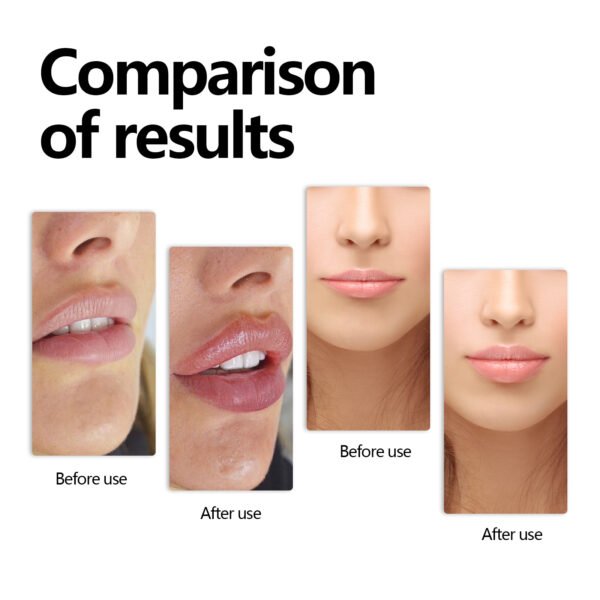 Lip Serum Lip Moisturizing, Anti-Cracking - Image 4