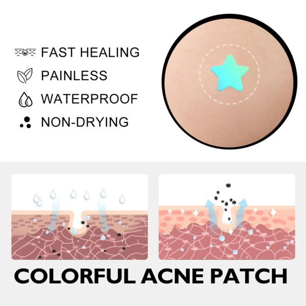 Acne Patches Reduce Acne & Pimples - Image 3