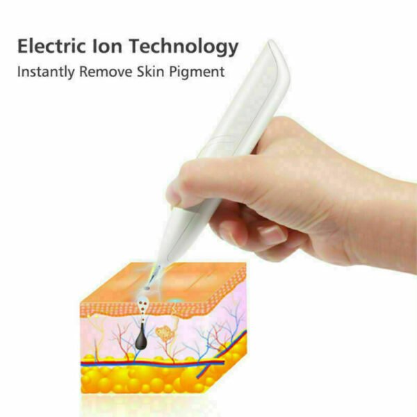 Ion Laser Freckle Skin Mole Dark Spot Remover Face Wart Tag Tattoo Removal Pen - Image 5